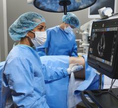 GE Healthcare had integrated artificial intelligence algorithms into many of its device technologies. Recently the vendor introduced AI-enabled real-time automated ejection fraction measurements on its Venue Go point of care ultrasound system.   