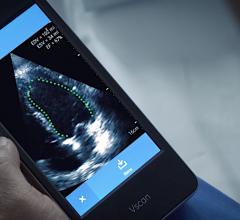 GE Healthcare Vscan with artificial intelligence (AI) automated left ventricular ejection fraction assessment with the Dia LVivo EF app. #ASE2020