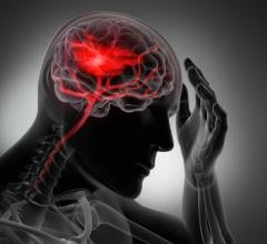 George Washington University Researchers have found that post-stroke language and orientation impairments predicted recurrent stroke, while attention deficit impairment was associated with increased risk of death.