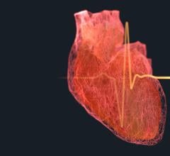AB-1002 is being studied for the treatment of adults with non-ischemic cardiomyopathy and New York Heart Association (NYHA) Class III heart failure symptoms
