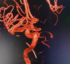 Millions of patients worldwide could benefit from better long-term outcomes by the company’s expansion into peripheral artery disease