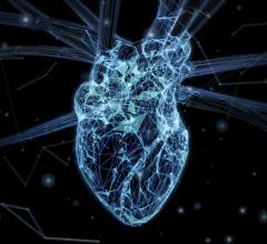 The Society for Cardiovascular Angiography & Interventions (SCAI) has released a position statement on Renal Denervation (RDN), emphasizing patient selection, optimal techniques, competence, training, and institutional recommendations 