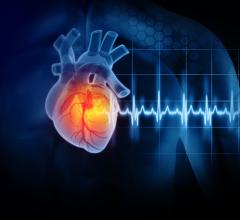 Featured presentation on the time to clinical benefit of sotagliflozin in people with worsening heart failure 