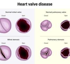 Roughly 25,000 Americans die each year from valvular heart disease, but researchers from Rutgers Health and other institutions conclude that new technology could soon help doctors slash that number