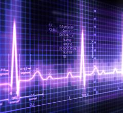  A new study found that differences between a person's age in years and his or her biological age, as predicted by an artificial intelligence (AI)-enabled EKG, can provide measurable insights into health and longevity.