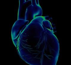 Individuals with diabetes display a substantially increased risk of disease in left-sided heart valves compared to controls without diabetes, a comprehensive register study at the University of Gothenburg shows. 