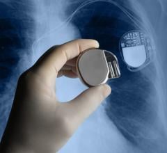 The global pacemakers market is set to grow at a compound annual growth rate (CAGR) of 5.4% between 2022 and 2025, driven by increasing population at a risk of cardiovascular diseases. 