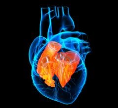 People with a congenital heart defect who were hospitalized with COVID-19 infection were at higher risk for severe illness or death than those without a heart defect, according to new research published in the American Heart Association’s flagship, peer-reviewed journal Circulation.