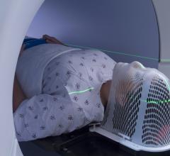 People exposed to low doses of ionizing radiation have an extra, but modest, risk of developing heart disease during their lifetime, according to a new study