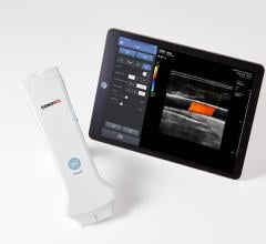 Healcerion Receives FDA Approval for Sonon 300L Handheld Ultrasound Device