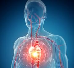 Report: AI Could Help ID Hidden Heart Failure Nine Months Earlier