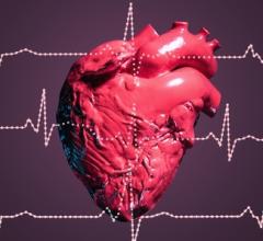 New Research Shows Strong Support for AI in Preventive Cardiac Screening
