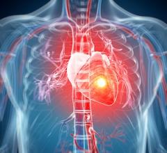 Global Experts Update Heart Failure Definition