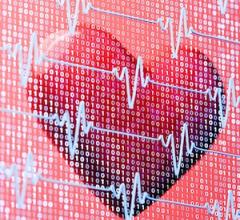 AHA Accepting Applications for 2026 Health Tech Competition