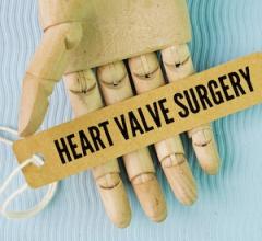 Study Shows Heart Valve Replacement Has Different Risks for Women and Men