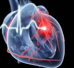 Abbott Technologies Included in Updated ESC Heart Failure Guidelines