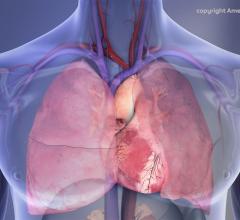 Human Chest Cavity illustration: Right lung, left lung, heart. Copyright American Heart Association 