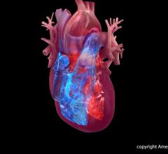 Heart failure associated with methamphetamine (meth) use has risen dramatically in recent years among U.S. veterans, according to preliminary research presented at the 2017 American Heart Association (AHA) Scientific Sessions.
