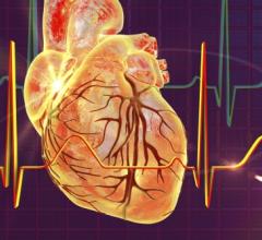 The algorithm may help clinicians find atrial fibrillation in people without symptoms 