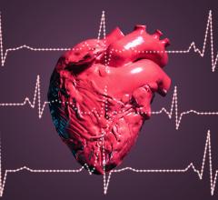 cardiac output, algorithm, 
