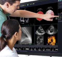TomTec offers innovations in cardiac ultrasound, including AI and auto quanitification of echo images.