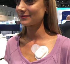 An example of the new generation of inexpensive, wearable cardiac monitors. This is the Cardiac Insight Cardea Solo device. #ACC18