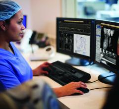 The cardiology information system (CVIS) — IntelliSpace Cardiovascular from Philips Healthcare, being used in the cath lab.