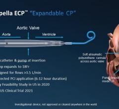 The U.S. Food and Drug Administration (FDA) has granted breakthrough device designation to Abiomed’s new Impella ECP expandable percutaneous heart pump. The designation means the FDA will prioritize Impella ECP’s regulatory review processes including design iterations, clinical study protocols and pre-market approval (PMA) application.