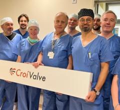 CroíValve has announced the successful First in Human implants of its DUO Tricuspid Coaptation Valve technology for the treatment of Tricuspid Regurgitation as part of its TANDEM I study in Poland. 