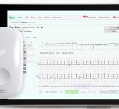 Telecradiology remote monitroing programs grew rapidly during the COVID-19 pandemic. An example of a remote cardiac monitor that saw increased use is InfoBionic's MoMe Kardia device. It offers mobile cardiac telemetry with near real-time, on-demand full disclosure of ECG data 24/7. Using a wearable monitor, MoMe continuously records telemetry data, uploading it to a cloud-based platform that clinicians may access at anytime.