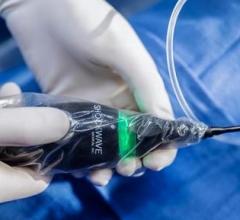 Johnson & Johnson Introduces Coronary IVL Catheter