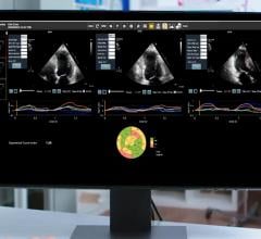 Circle Cardiovascular Imaging Partners With DiA Imaging Analysis to Deliver AI-Based Cardiovascular Imaging Solutions