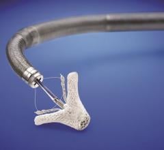 MitraClip, Abbott, transcatheter mitral valve repair, FDA approval
