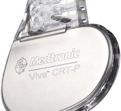 Medtronic AdaptResponse Global Clinical Trial Cardiac Resynchronization Therapy