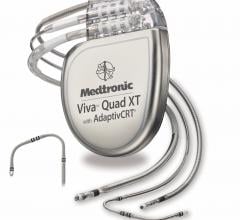 Medtronic AdaptivCRT Feature Associated with Improved Heart Failure Patient Survival
