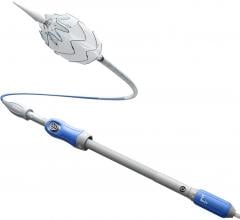 Medtronic Receives FDA Approval for Valiant Navion Thoracic Stent Graft System