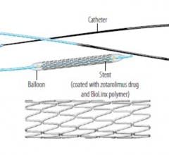 Medtronic's Resolute Integrity Zotarolimus-eluting Coronary Stent System received an additional U.S. Food and Drug Administration (FDA) indication for treatment of de novo chronic total occlusion (CTO) lesions. 