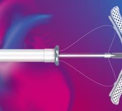 New results demonstrate MitraClip transcatheter edge-to-edge repair (TEER) is effective at treating leaky valves in people with secondary mitral regurgitation (MR)