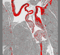This image shows the mitral valve of the heart of a mouse that lacks the serotonin transporter (SERT) gene. The valve was stained with prico-sirius red to show collagen. SERT knockout mice had a thickened mitral valve compared to normal mice. Image courtesy of Columbia University Irving Medical Center 