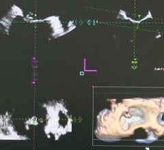 Bay Labs Announces New Echocardiography Guidance Software Data at ASE 2019 Scientific Sessions