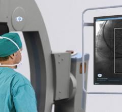  Omega Medical Imaging Launches AI-enabled FluoroShield for Radiation Reduction