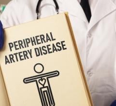 VA Study: Referrals for PAD Nearly Triple Over Five Years