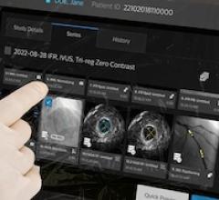 intravascular imaging, interventional, cardiac