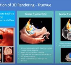 WEBINAR: 3-D Multi-planar Imaging to Enhance Ultrasound Guidance of Interventional Cardiac Procedures using Philips Technology.