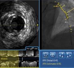 Philips Showcases Integrated Solutions for Cardiovascular Care at TCT 2018