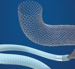 Medtronic is recalling its Pipeline Flex Embolization Device and Pipeline Flex Embolization Device with Shield Technology, which are transcatheter devices used to seal brain aneurysms. The company said there is a risk of the delivery system’s wire and tubes fracturing and breaking off when the system is being used to place, retrieve, or move the stent inside a patient.