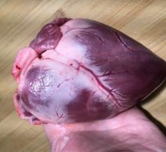 Transplanting Pig Hearts Into Humans One Step Closer. A pig heart, shown here, is very similar in size and anatomy to a human heart. For this reason, pigs are used extensively in pre-clinical animal testing for new implantable cardiovascular devices. If pig hearts could be used for human transplantation, it would greatly alleviate shortages of donor human hearts.