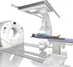 Post-Mortem CT Angiography Illuminates Causes of Death