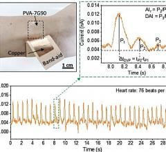 A team from Purdue University developed self-powered wearable triboelectric nanogenerators with polyvinyl alcohol-based contact layers for monitoring cardiovascular health.