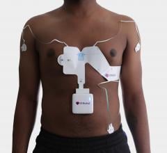 The QT Medical PCA 500 12-lead ECG system uses a unique wearable wrap that contains all the leads and eliminated the need to connect separate wire electrodes to the patient. The simplicfication of lead placement enables the system to be used by patients at home.